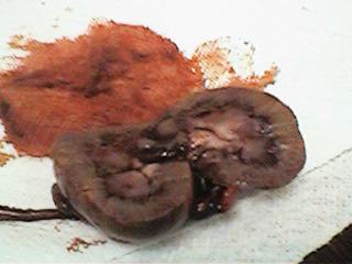 Bug's Kidney